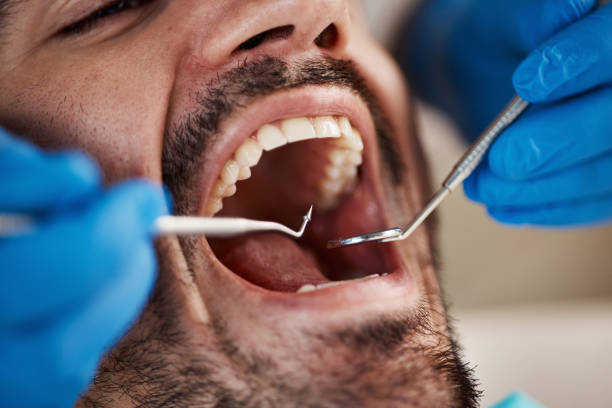 Best Tooth Infection Emergency Dentist  in Wabasso Beach, FL